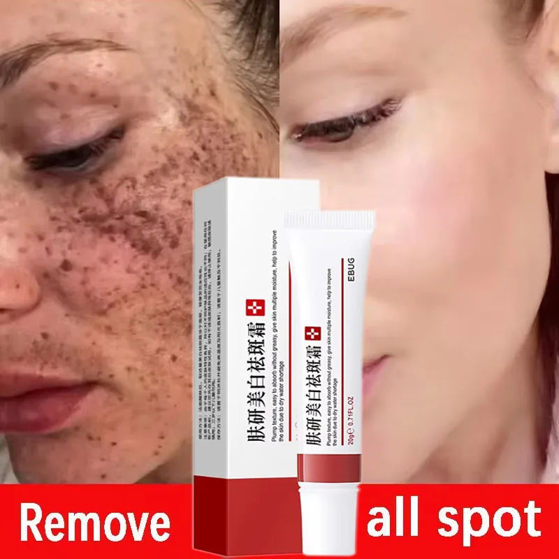 Effective Spot Removing Face Cream Whitening Freckle Remove Melasma Fade Melanin Anti-Pigmentation Improve Dullness Skin Care