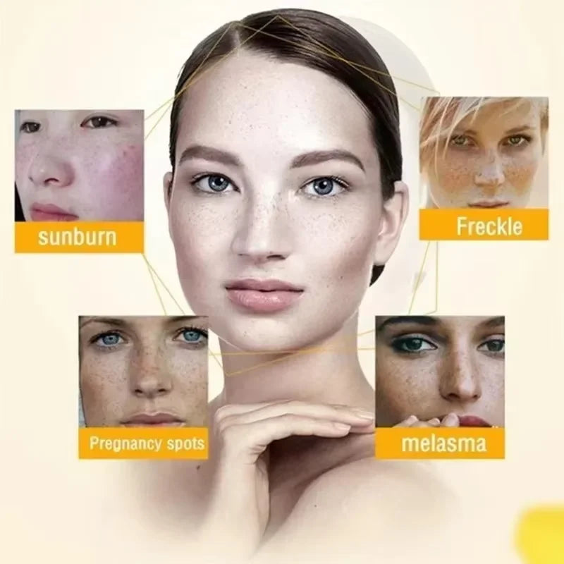 Effective Spot Removing Face Cream Whitening Freckle Remove Melasma Fade Melanin Anti-Pigmentation Improve Dullness Skin Care