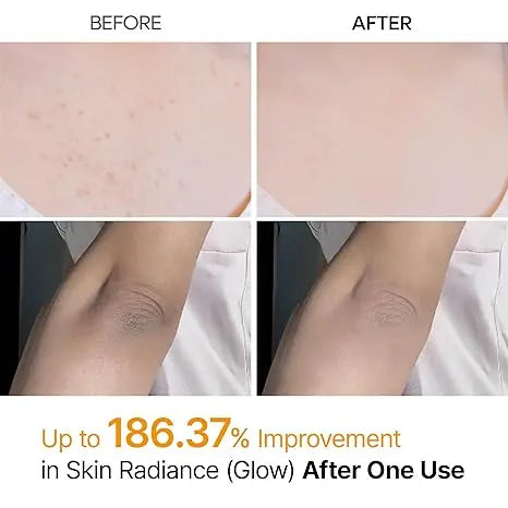 Dr.Melaxin Body Keratin Care Kojic Acid Turmeric Spray Gently Exfoliating Peeling Solution Korean Skincare All Skin Types 200ml