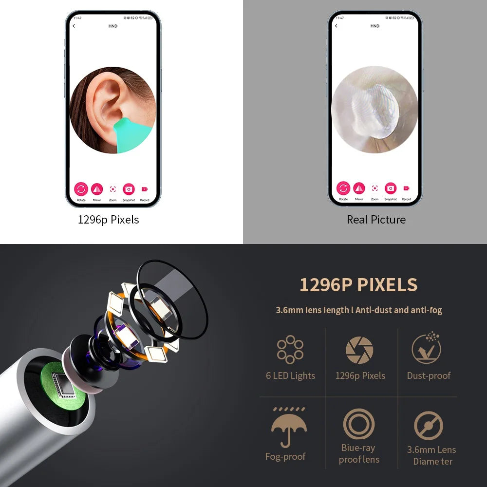 Smart Visual Ear Cleaner with HD Camera