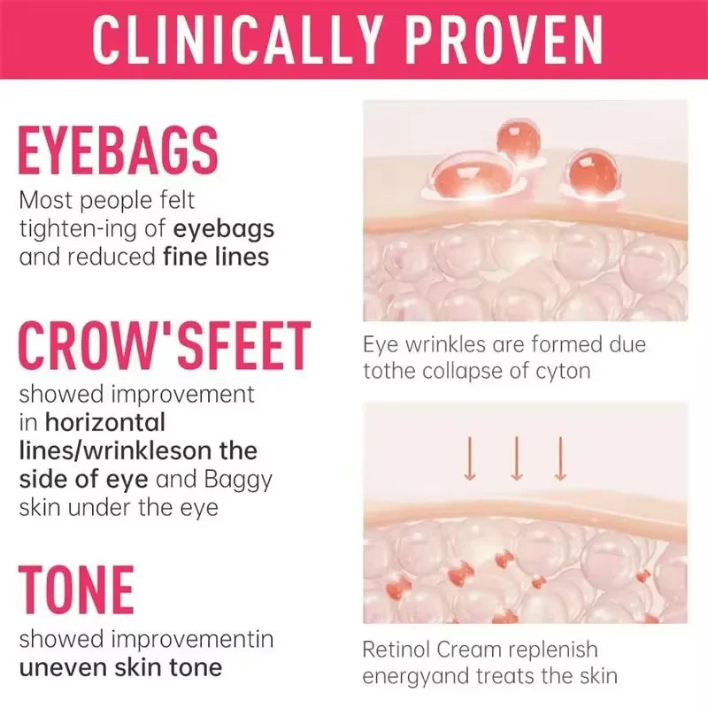 Instant Eye Bag Removal Cream Retinol Anti-Wrinkle Firming Skin Fade Fine Lines Anti Dark Circle Puffiness Brighten Eye Care
