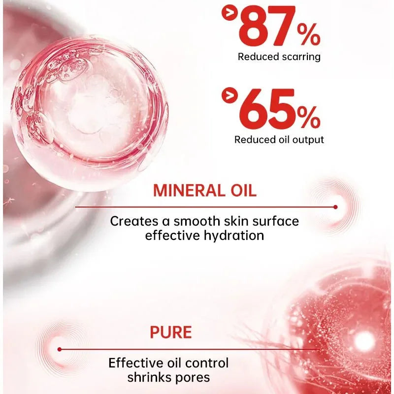 Effective Scar Removal Cream Fast Treatment Stretch Marks Burn Surgical Scars Acne Spots Repair Whitening Moisturizing Skin Care